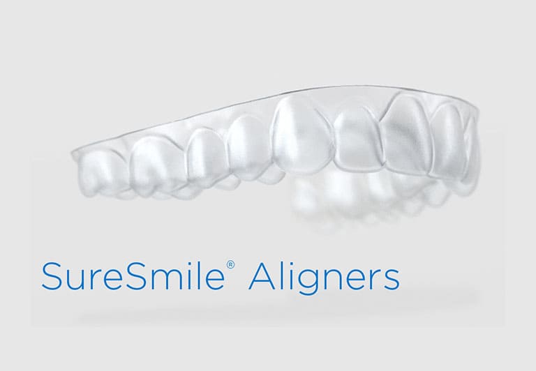 SureSmile（シュアスマイル）