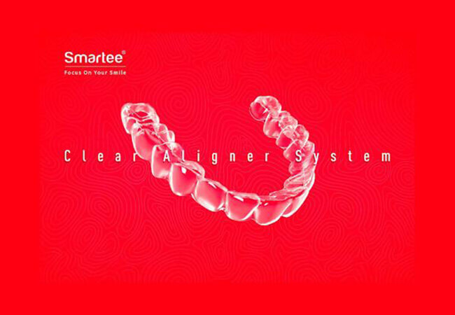 Smartee矯正とは