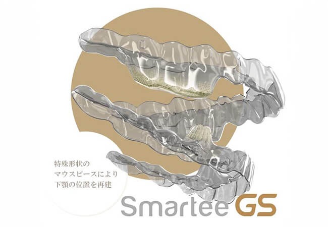 SmarteeGSによる顎位再建