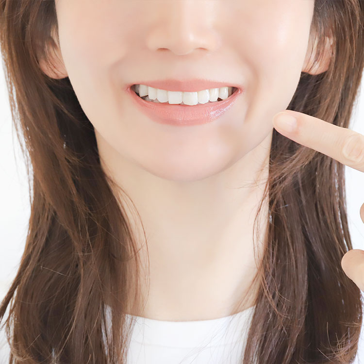 自然な美しさを叶えるラミネートベニア