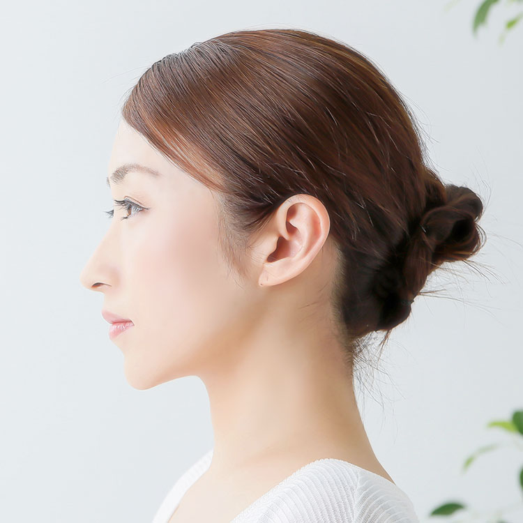 横顔(E-Line)矯正