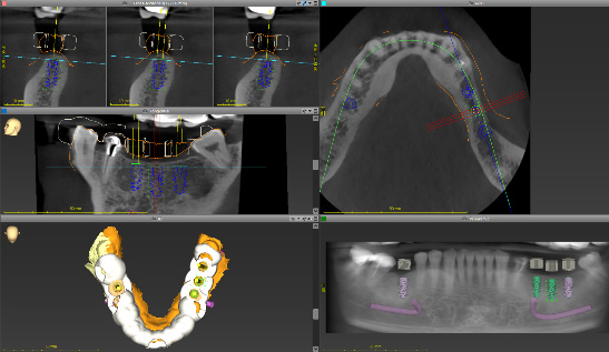 オールデジタル設計