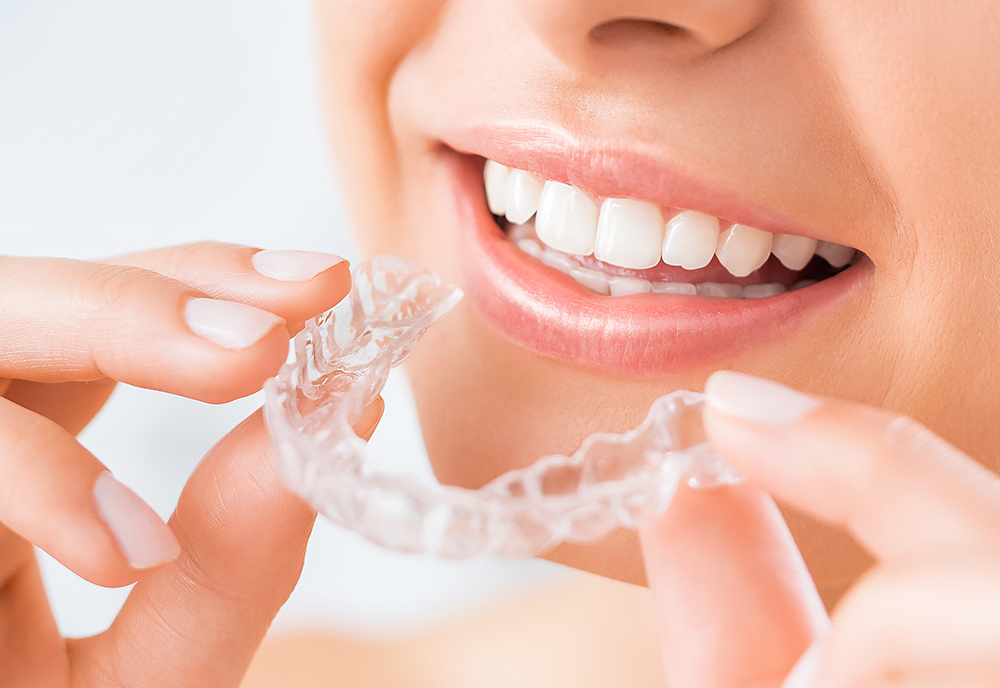 🦷 What Is Invisalign? Why Is the Retainer Stage So Important?