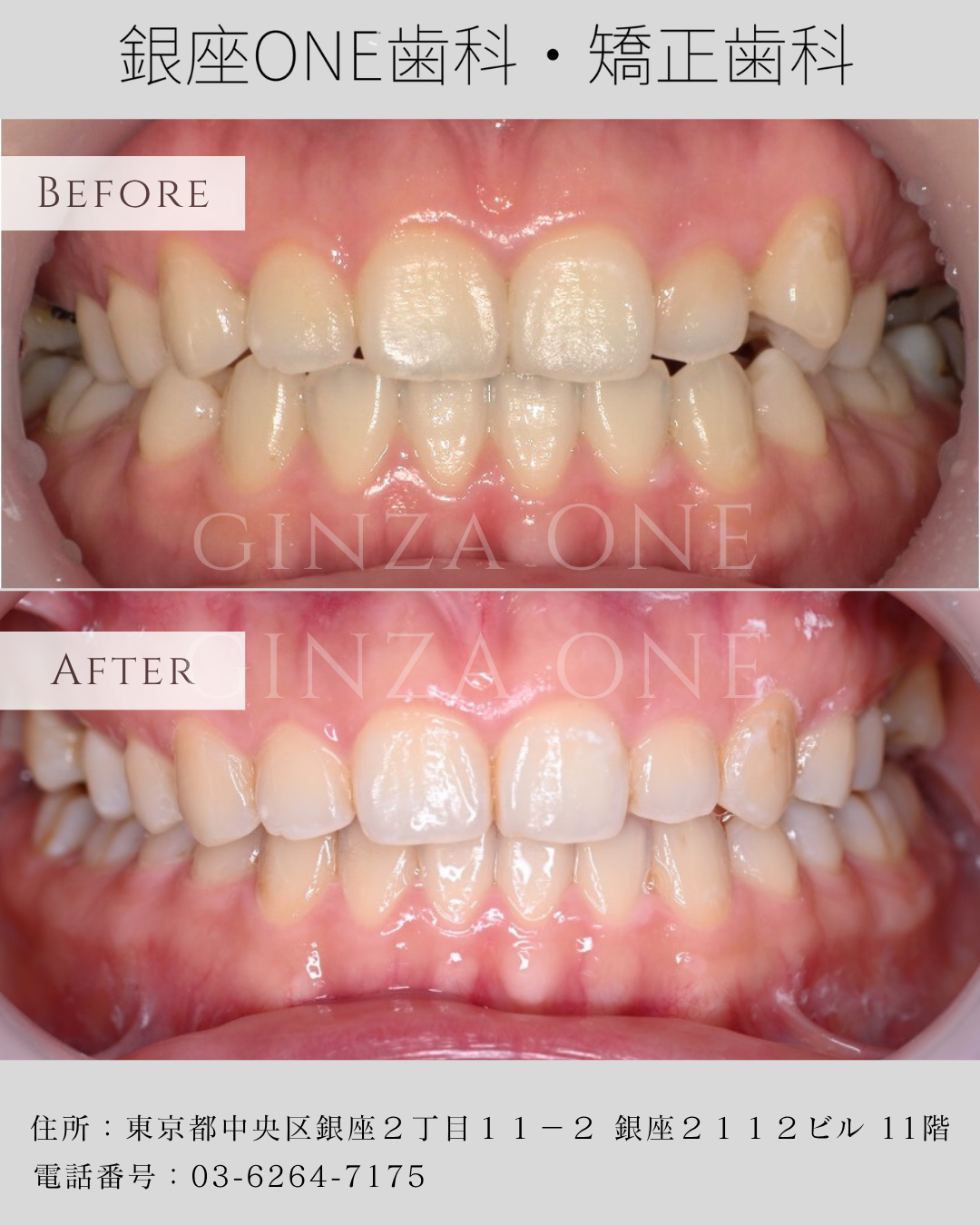 矫正前一定要做的 5 项检查｜为什么初诊这么重要？