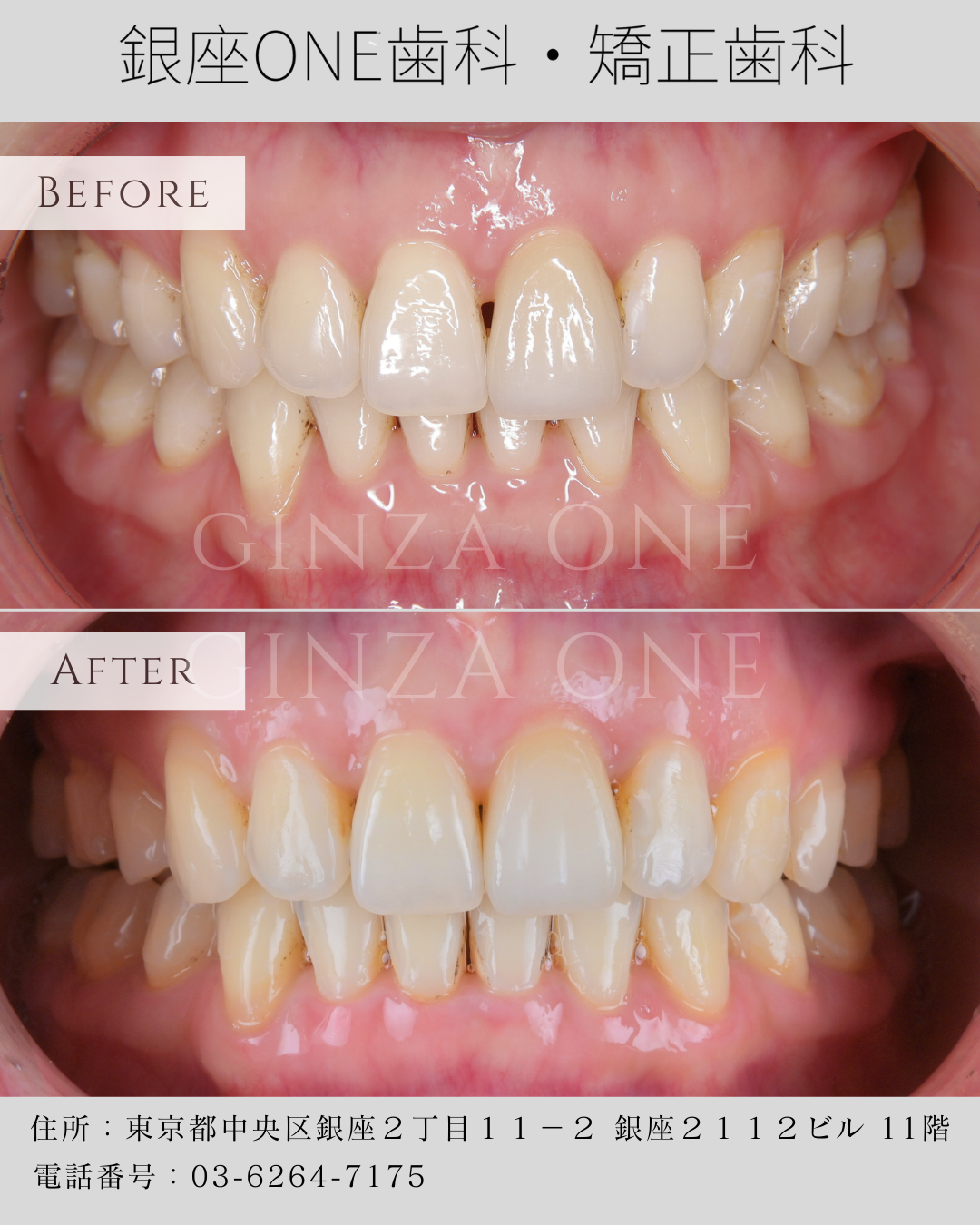 矯正したいけれど、何から始めればいい？