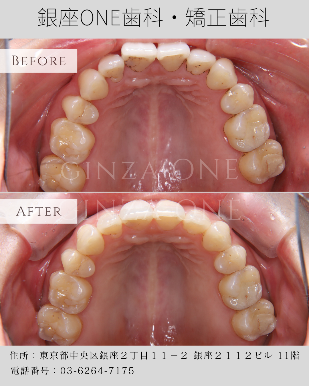 想矫正，但不知道从哪一步开始？