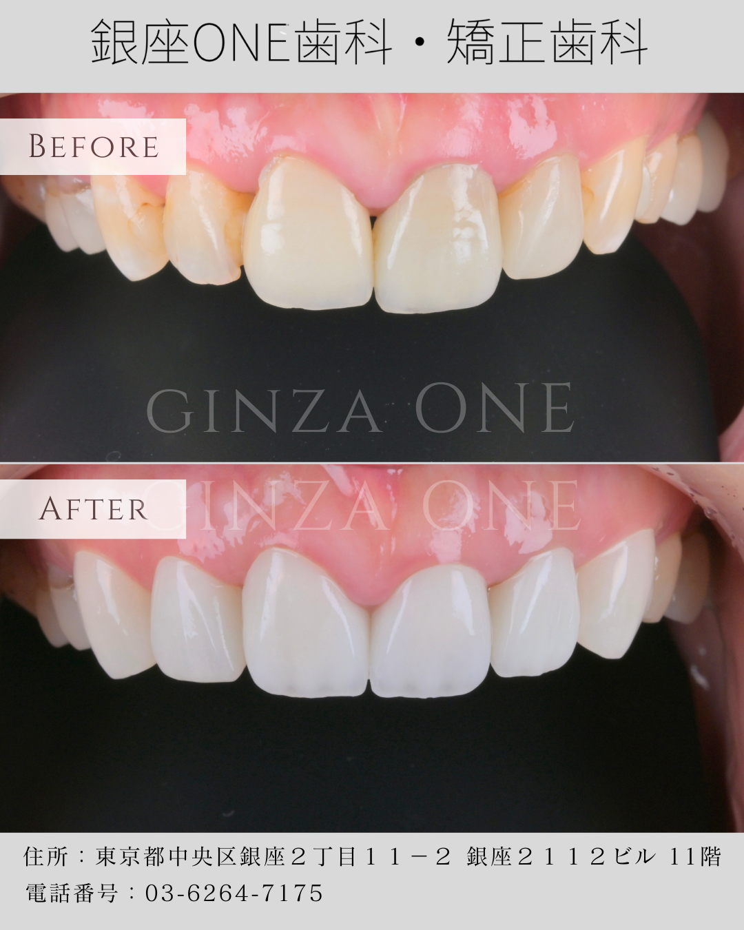 医療コラム｜銀座ONE歯科・矯正歯科｜銀座一丁目、有楽町、銀座駅から