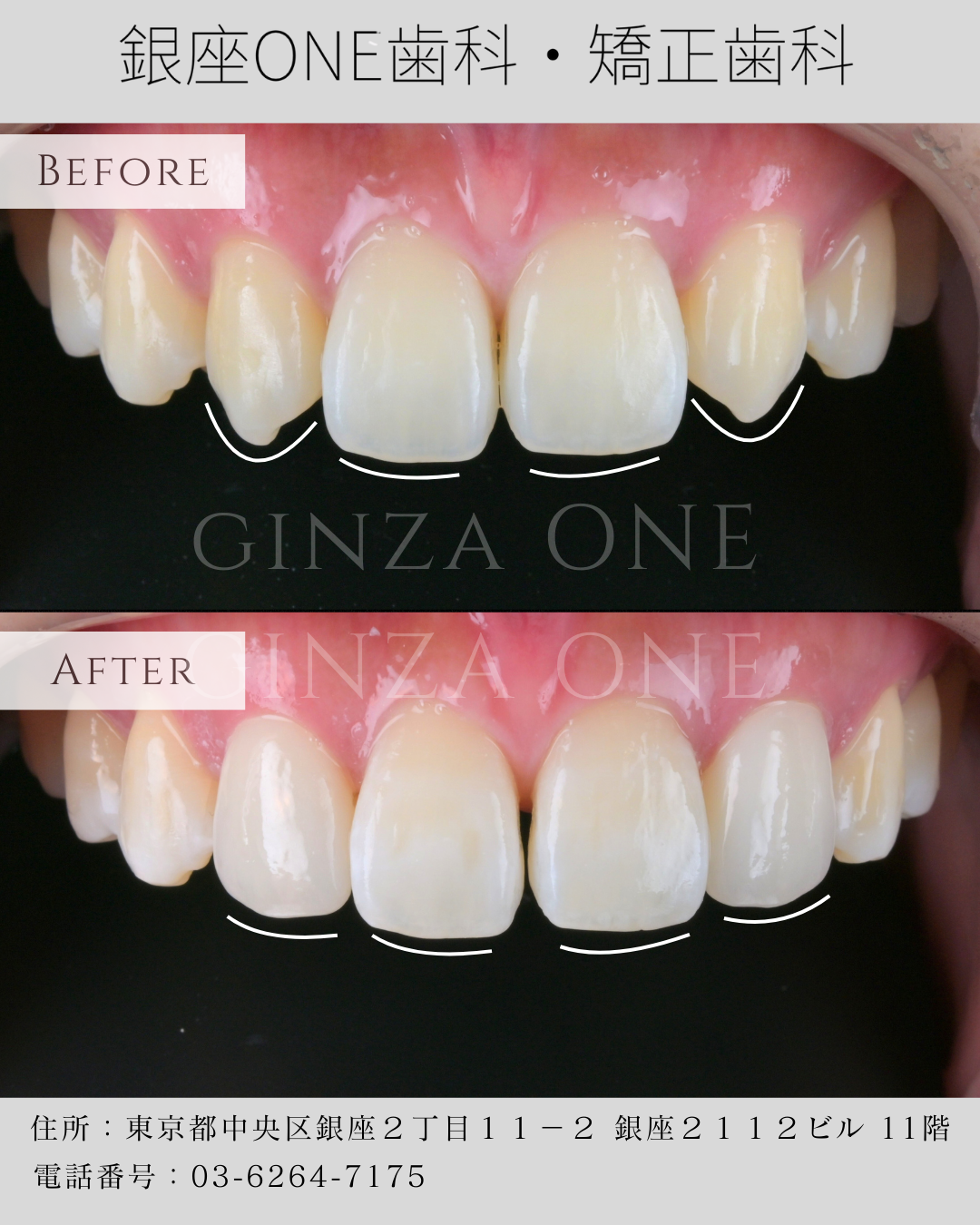 银座ONE式 —— 设计自然微笑