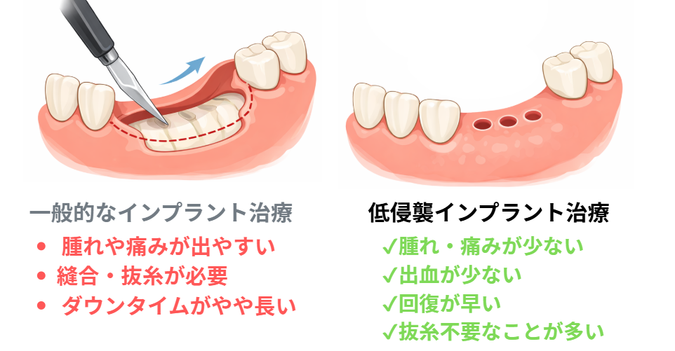 种植牙＝可怕？是真的吗？