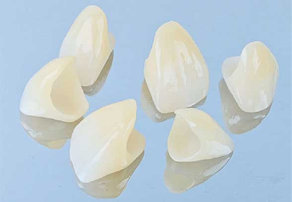 ジルコニア・セラミッククラウン（被せ物）