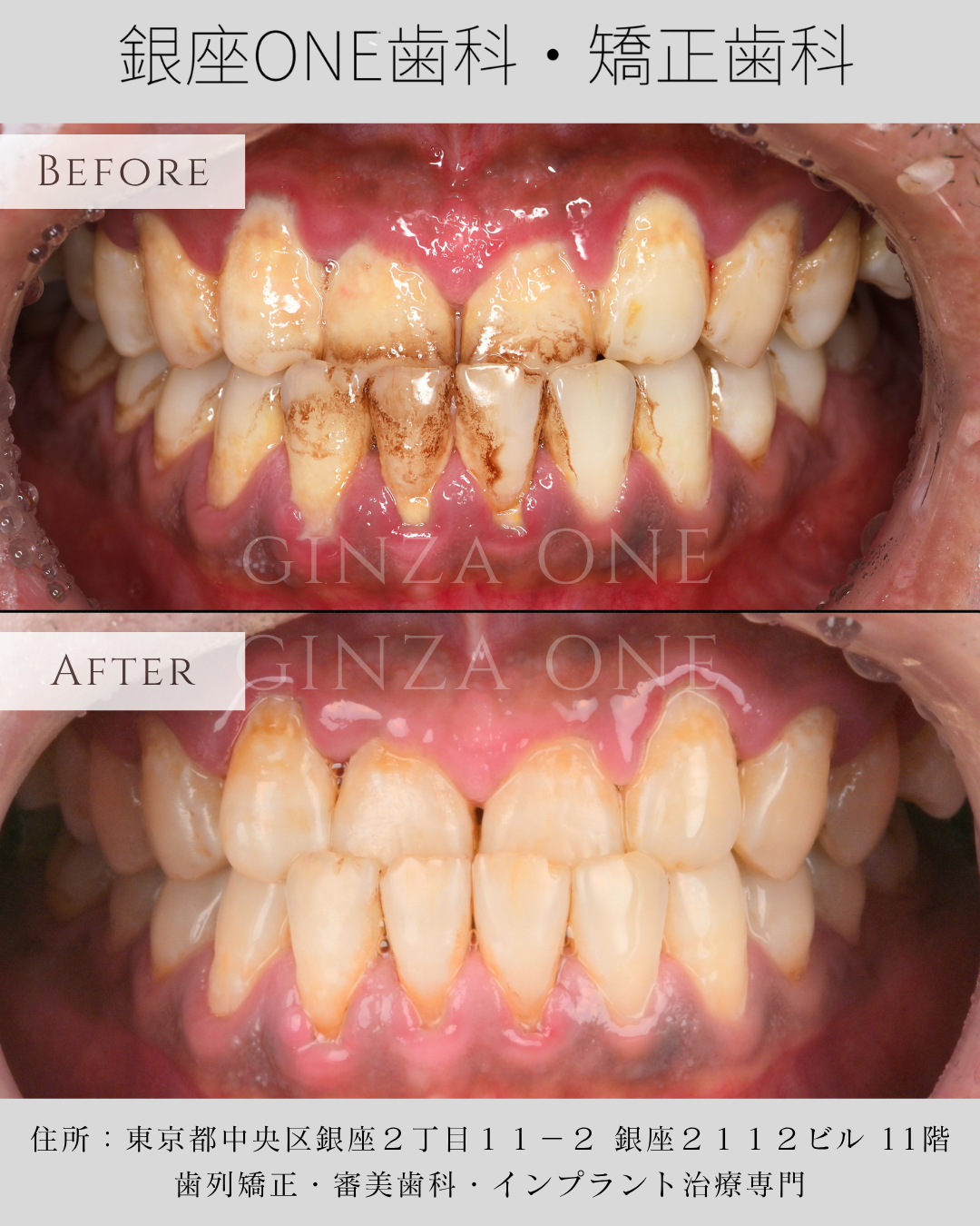 Elevate Your Look at a Low Cost — Start by Bringing Back Your Teeth’s Natural Brightness ✨