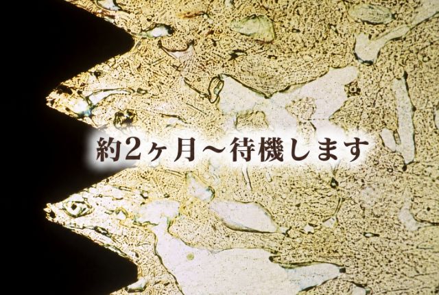治癒期間(オッセオインテグレーション)